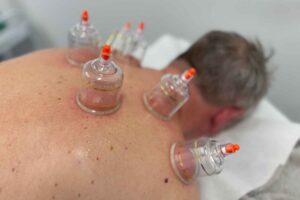 Dry Cupping (h)